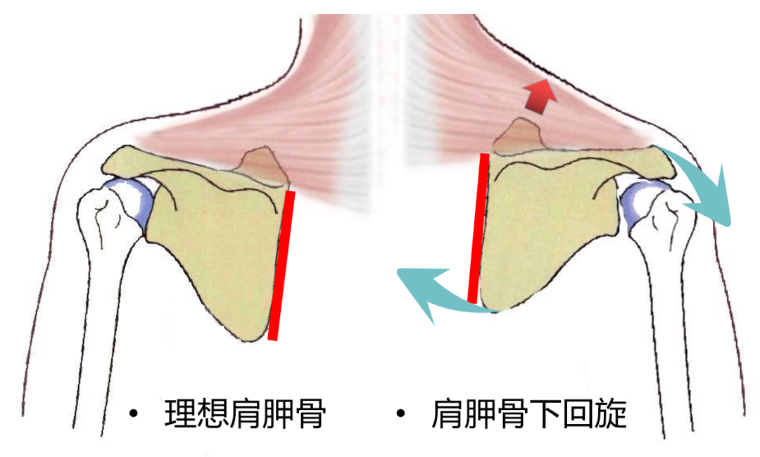 肩胛骨在理想的位置下的时候,斜方肌是平缓舒适地躺在上面的,坡度自然